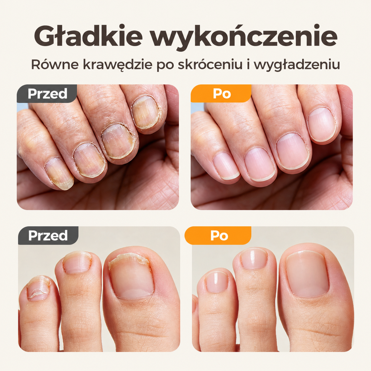 Efekt przed i po skróceniu oraz wygładzeniu paznokci